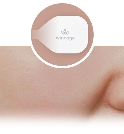 위너지 볼륨 회복과 탄력 강화