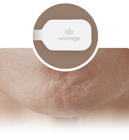 위너지 볼륨 회복과 탄력 강화