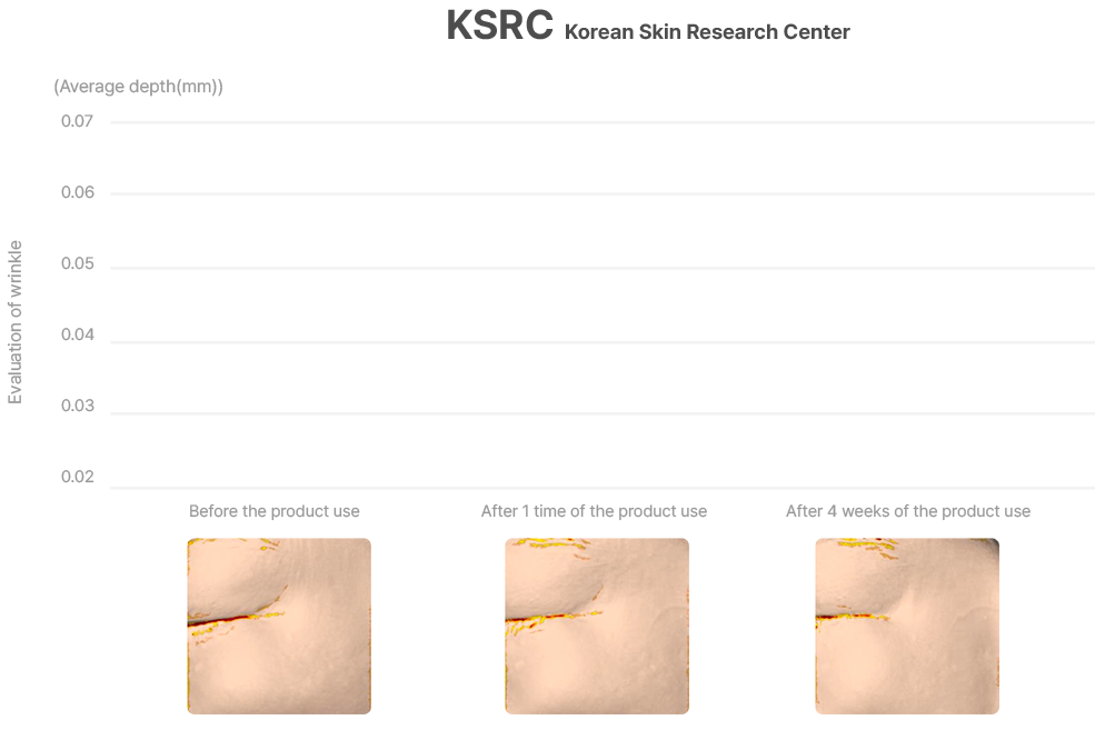 위너지 볼륨 회복과 탄력 강화